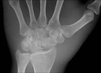 Digital radiography