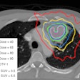 2011 05 11 14 00 56 747 Estro Clinical 394