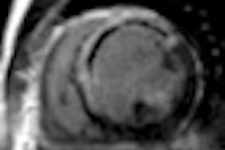 2011 05 27 11 54 16 218 2011 05 30 Cardiac Mr Thumb