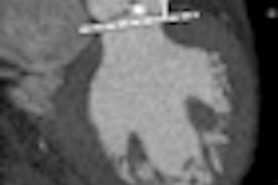 2011 05 27 12 36 09 365 2011 05 31 Cardiac Ct Thumb