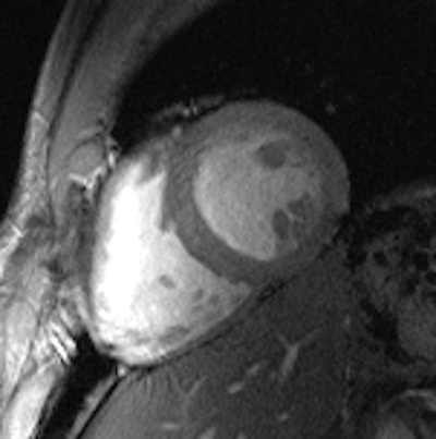 Cine image of the beating heart: short-axis view
