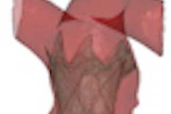 2011 06 06 08 58 29 978 2011 06 01 Cardiac Thumb