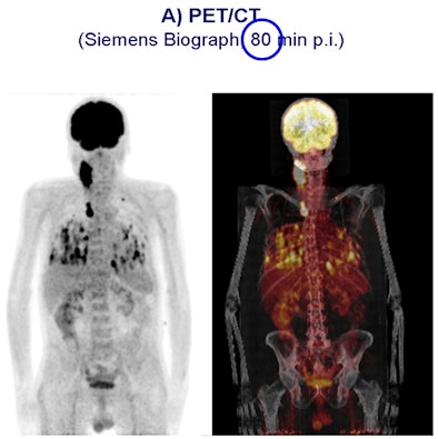 2011 06 07 11 04 01 655 Petmri 80min Top 394