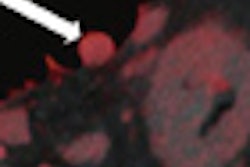 2011 06 15 09 54 33 289 Graser thumb 0611 Comp