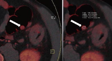 2011 06 15 09 54 35 289 Graser middle