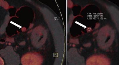 2011 06 15 09 54 35 289 Graser middle