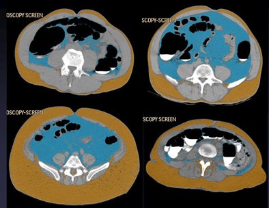 2011 06 20 14 09 06 581 Pickhardt visc fat four images