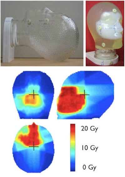 Gel dosimeters enable true 3D dosimetry. Image courtesy of Yves De Deene from Ghent University.