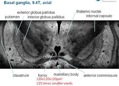 Basil ganglia at 9.4 tesla