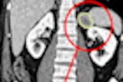 2011 06 28 09 12 59 565 2011 06 27 Cad Thorax Followup Thumb