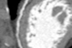2011 06 30 10 01 53 475 2011 06 30 Cardiact Ct Image1 Thumb