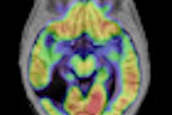 2011 06 30 14 10 16 200 2011 07 01 Mri Brain