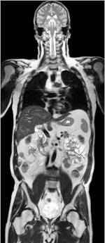 MR investigations of the spine and brain tend to be common sources of errors. Image courtesy of Philips Healthcare.