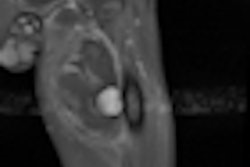 2011 07 11 13 30 43 812 2011 07 12 Gunshot Thumb