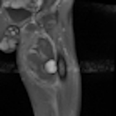 2011 07 11 13 30 43 812 2011 07 12 Gunshot Thumb