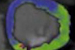 2011 07 11 15 33 08 870 2011 07 12 Perfusion Ct Thumb