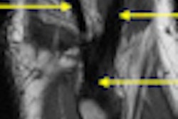 2011 07 14 09 45 55 121 2011 07 15 Knee Mri Thumb