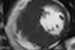 2011 07 15 14 52 05 333 2011 07 18 Cine Mri Thumb