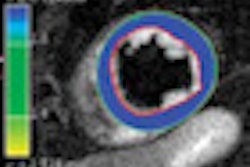 2011 07 18 15 47 40 123 Mr Cardiomyo Fig3 70