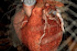 2011 07 25 13 12 46 935 2011 07 27 Single Beat Cardiac 70