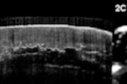 2011 07 29 12 21 57 357 2011 07 29 Psoriasis