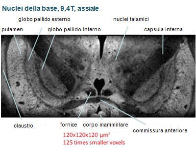 Una immagine dei nuclei della base a 9,4T