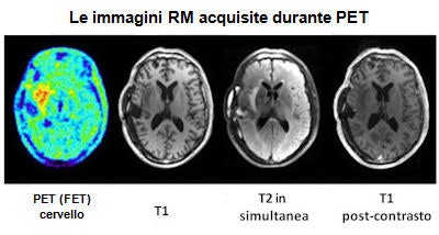 Le immagine RM acquisite durante PET