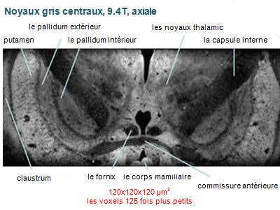 L'image des noyaux gris centraux obtenue à 9.4 tesla