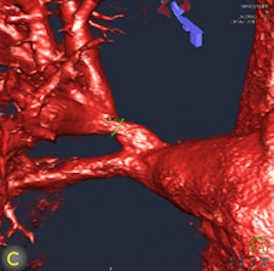 2011 08 05 12 52 35 129 2011 08 08 Flat Panel 2c