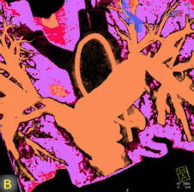 2011 08 05 12 52 37 188 2011 08 08 Flat Panel 2b