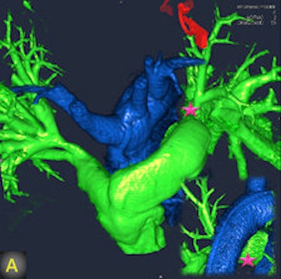 2011 08 05 12 52 39 780 2011 08 08 Flat Panel 2a