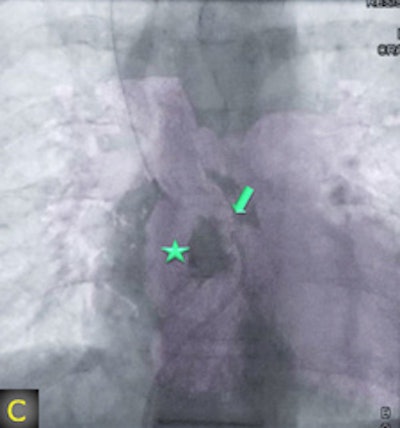 2011 08 05 12 52 42 988 2011 08 08 Flat Panel 1c