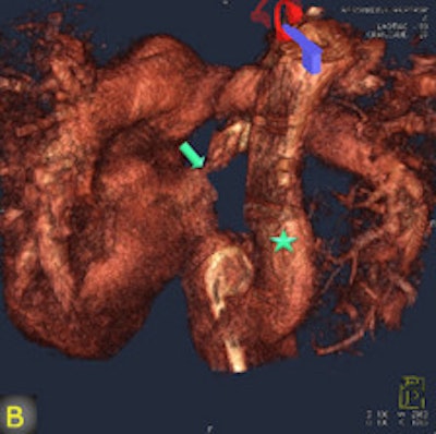 2011 08 05 12 52 44 960 2011 08 08 Flat Panel 1b