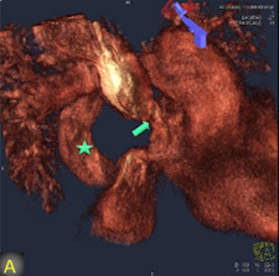 2011 08 05 12 52 45 855 2011 08 08 Flat Panel 1a