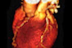 2011 08 23 10 55 22 602 2011 08 24 Cardiac Ct Thumb