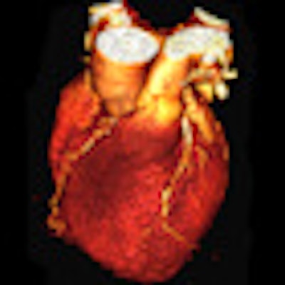 2011 08 23 10 55 22 602 2011 08 24 Cardiac Ct Thumb