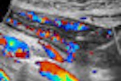 2011 08 25 11 38 03 159 2011 08 26 Wfumb1 Thumb