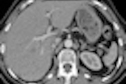 2011 08 26 11 18 19 744 2011 08 29 Safire Recon Thumb