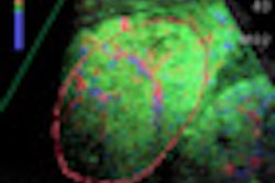 2011 08 30 11 33 19 832 2011 08 31 Wfumb4 Thumb