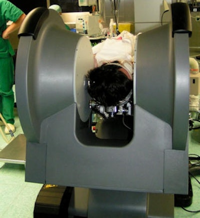 A sample image showing the surgical setup, with the patient's head positioned in between the bores of the magnet; during surgery, imaging is repeated with sterile drapes placed around the head and the bores. All images courtesy of Dr. Christian Senft.