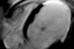 2011 09 01 11 54 16 12 2011 09 02 Esc3thumb
