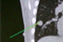 2011 09 09 11 05 00 328 2011 09 12 Cleary Thumb