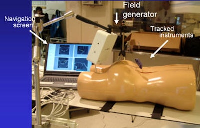 Above, image-guided vertebroplasty using electromagnetic tracking, performed on a phantom. Below, graphic user interface of vertebroplasty image-guidance software. All images courtesy of Kevin Cleary, PhD.