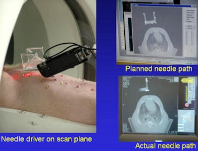 Robot-assisted lung biopsy in a swine model by Xu et al.