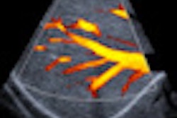 2011 09 12 08 15 00 492 2011 09 12 Ultrasound Market Thumb2
