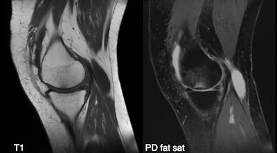 Knee MR images; images were exported from an iPad 2