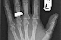 2011 09 14 12 00 09 742 2011 09 15 Pacs Thumb