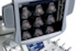 2011 09 15 15 30 18 113 Logiq9 70