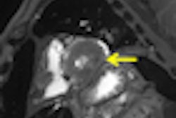 2011 09 20 11 24 41 872 2011 09 21 Postmortem Thumb