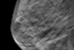 2011 09 21 08 15 47 934 2011 09 21 Mammo Thumb